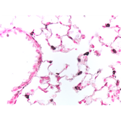 The picture shows adult mouse lung tissue embedded in paraffin and stained with anti-N-terminal proSP-C rabbit serum (1:3000 dilution). ProSP-C was visualized by DAB (black color) and counterstained with Nuclear Fast Red (pink color). Magnification 40X