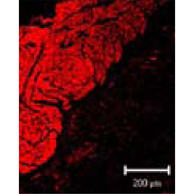 Anti-Smooth Muscle Actin - Mouse (B4)