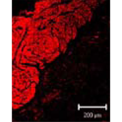 The picture shows an immunofluorescent stain, detrusor muscle detected with anti-smooth muscle actin B4.