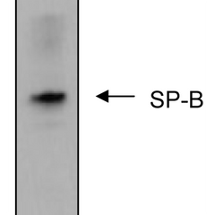 The picture shows human bronchoalveolar lavage fluid subjected to non-reducing SDS-PAGE, transferred to nitrocellulose, and immunoblotted with anti-SP-B (1:5000 dilution). Protein bands were revealed using a HRPconjugated goat anti-mouse secondary antibody and a chemiluminescent detection system.