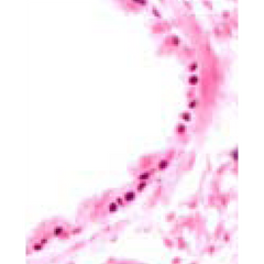 The picture shows an immunohistochemical stain of adult mouse lung that was embedded in paraffin and stained with anti-FOXJ1 using a MOM kit (Vector Labs). FOXJ1 was visualized by DAB (black color) and counterstained with Nuclear Fast Red (pink color). Magnification 40x.
