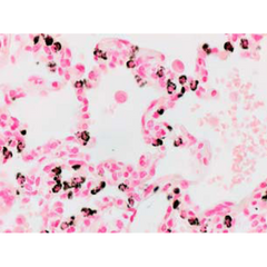 Anti-ABCA3 - Mouse (17-H5-24) Immunohistochemical Stain